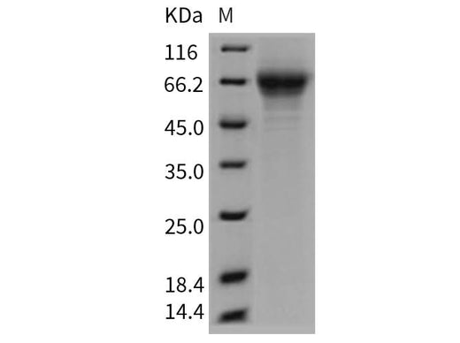 Recombinant Mouse THSD1/TMTSP Protein (His Tag) - ABMIUM