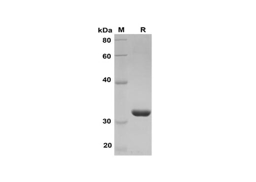 SDS-PAGE analysis of Human FGF basic proteins, 2 μg/lane of Recombinant Human FGF basic proteins was resolved with SDS-PAGE under reducing conditions, showing bands at 33 kDa.
