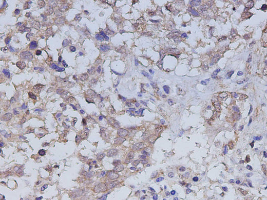 Anti-Human ILK Antibody - ABMIUM
