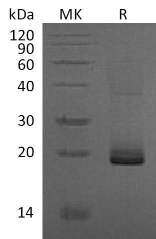 Recombinant Mouse ESM1/Endocan Protein (Human Cells, His Tag) - ABMIUM