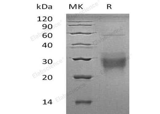 Recombinant Human NFYA Protein (GST Tag) - ABMIUM