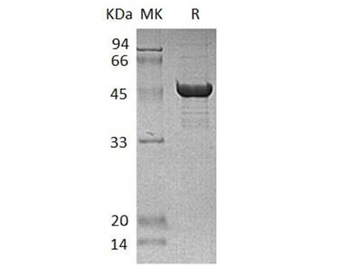 Recombinant Human SCLY Protein (His Tag) - ABMIUM