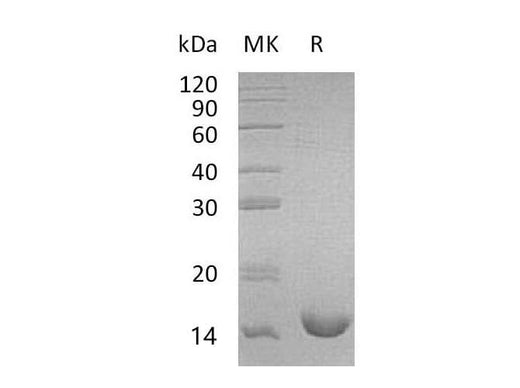 Recombinant Mouse Interleukin-16/IL-16 Protein (His Tag) - ABMIUM