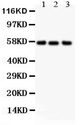Anti-Alkaline Phosphatase/ALPL Antibody Picoband® Boster Bio
