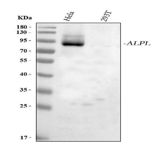 Anti-Alkaline Phosphatase/ALPL Antibody Picoband® Boster Bio