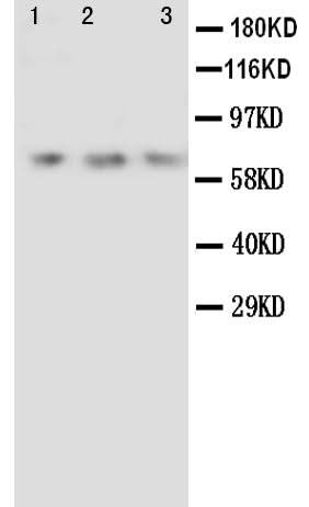 Anti-Angiopoietin 2/ANGPT2 Antibody Picoband® Boster Bio