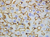 Anti-Annexin V/ANXA5 Antibody Picoband® Boster Bio
