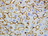 Anti-Annexin V/ANXA5 Antibody Picoband® Boster Bio