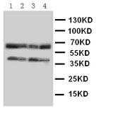 Anti-C-C chemokine receptor type 5 CCR5 Antibody Picoband® Boster Bio