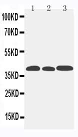 Anti-C-C chemokine receptor type 5 CCR5 Antibody Picoband® Boster Bio