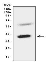Anti-C-C chemokine receptor type 5 CCR5 Antibody Picoband® Boster Bio