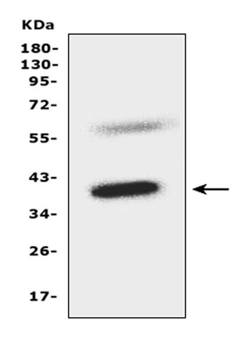 Anti-C-C chemokine receptor type 5 CCR5 Antibody Picoband® Boster Bio
