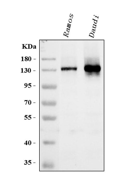 Anti-B-cell receptor CD22 CD22 Antibody Picoband® Boster Bio