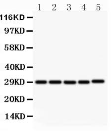 Anti-CD40L/CD40LG Antibody Picoband® Boster Bio