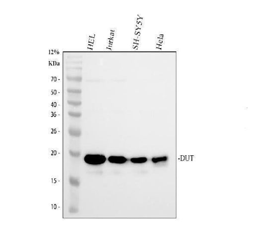 Anti-DUT Antibody Picoband® Boster Bio