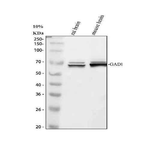 Anti-GAD67/GAD1 Antibody Picoband® Boster Bio