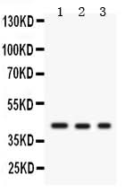 Anti-Neuromodulin GAP43 Antibody Picoband® Boster Bio