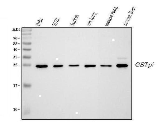 Anti-GST3/GST pi/GSTP1 Antibody Picoband® Boster Bio