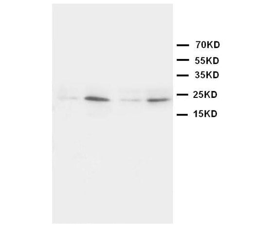 Anti-High mobility group protein B4 HMGB4 Antibody Picoband® Boster Bio