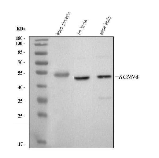 Anti-KCNN4 Antibody Picoband® Boster Bio