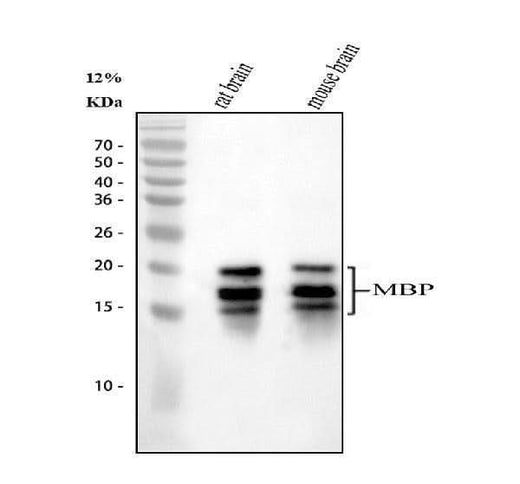 Anti-Myelin Basic Protein/MBP Antibody Picoband® Boster Bio
