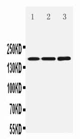 Anti-NMDAR2B/GRIN2B Antibody Picoband® Boster Bio