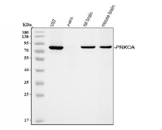 Anti-PKC alpha/PRKCA Antibody Picoband® Boster Bio