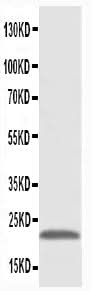 Anti-Phosphomevalonate kinase PMVK Antibody Picoband® Boster Bio