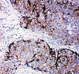 Anti-Metalloproteinase inhibitor 2 TIMP2 Antibody Boster Bio