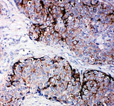 Anti-Metalloproteinase inhibitor 2 TIMP2 Antibody Boster Bio