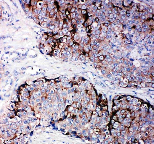 Anti-Metalloproteinase inhibitor 2 TIMP2 Antibody Boster Bio