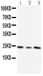 Anti-Metalloproteinase inhibitor 4 TIMP4 Antibody Picoband® Boster Bio