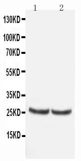 Anti-Metalloproteinase inhibitor 4 TIMP4 Antibody Picoband® Boster Bio