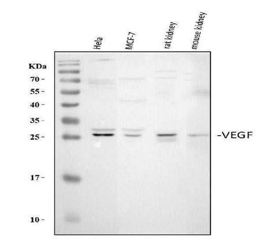 Anti-VEGF/VEGFA Antibody Picoband® Boster Bio