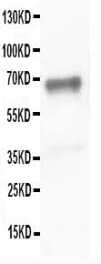 Anti-SHP2/PTPN11 Antibody Picoband® Boster Bio