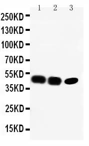 Anti-CCR6/CCR6 Antibody Picoband® Boster Bio