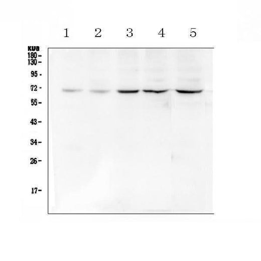 Anti-Chk2/CHEK2 Antibody Picoband® Boster Bio