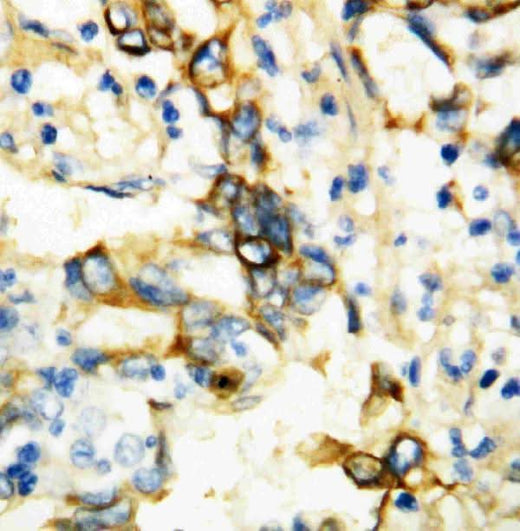 Anti-TNF Receptor I/TNFRSF1A Antibody Picoband® Boster Bio