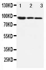 Anti-beta Catenin/CTNNB1 Antibody Picoband® Boster Bio