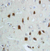 Anti-Hsp70/HSPA1A/HSPA1B Antibody Picoband® Boster Bio