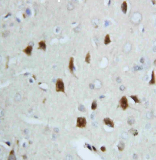 Anti-Hsp70/HSPA1A/HSPA1B Antibody Picoband® Boster Bio