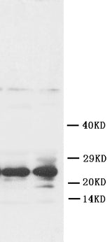 Anti-Fibroblast growth factor 8 FGF8 Antibody Picoband® Boster Bio