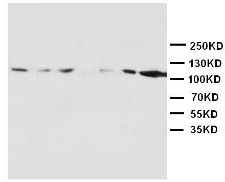 Anti-NMDAR1/GRIN1 Antibody Picoband® Boster Bio
