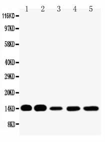 Anti-liver FABP/FABP1 Antibody Picoband® Boster Bio