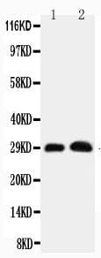 Anti-Aquaporin 5/AQP5 Antibody Picoband® Boster Bio