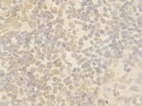 Anti-Cullin 4B/CUL4B Antibody Picoband® Boster Bio