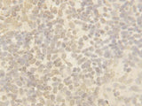 Anti-Cullin 4B/CUL4B Antibody Picoband® Boster Bio