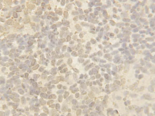 Anti-Cullin 4B/CUL4B Antibody Picoband® Boster Bio