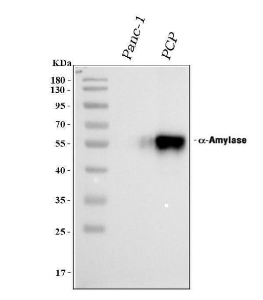 Anti-Alpha Amylase 1/AMY1A Antibody Picoband® Boster Bio