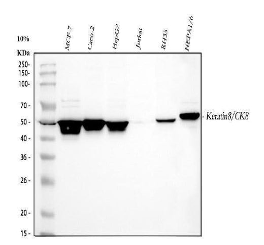 Anti-Cytokeratin 8/KRT8 Antibody Picoband® Boster Bio